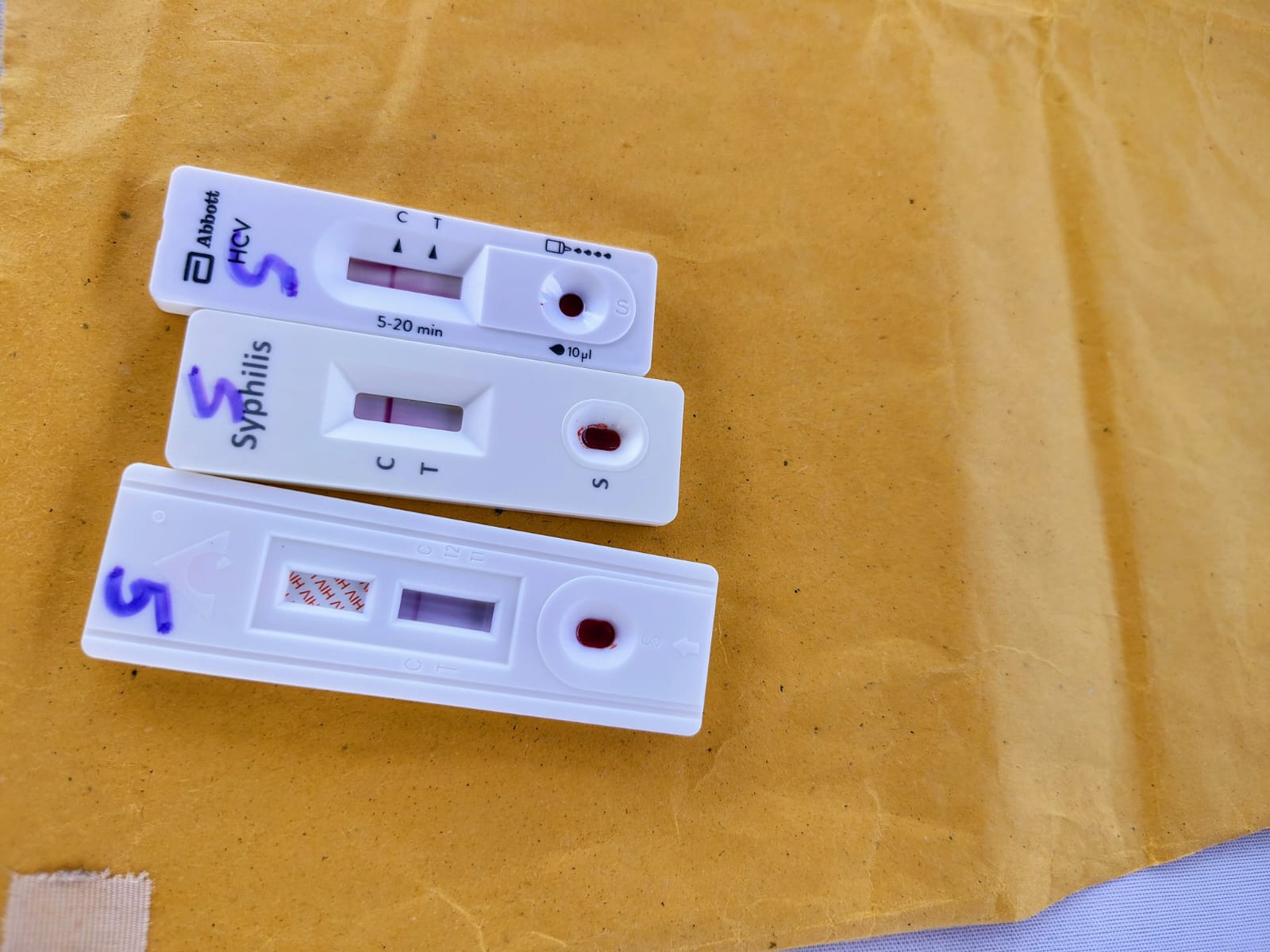 Lenacapavir, medicamento de acción prolongada para la prevención del VIH mediante dos inyecciones al año